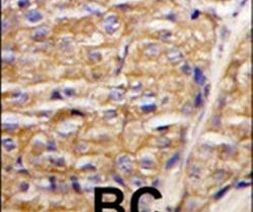 MIPEP Antibody in Immunohistochemistry (IHC)