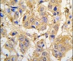 MIPEP Antibody in Immunohistochemistry (IHC)