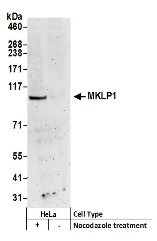 MKLP1 Antibody in Western Blot (WB)