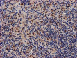 MKRN1 Antibody in Immunohistochemistry (Paraffin) (IHC (P))