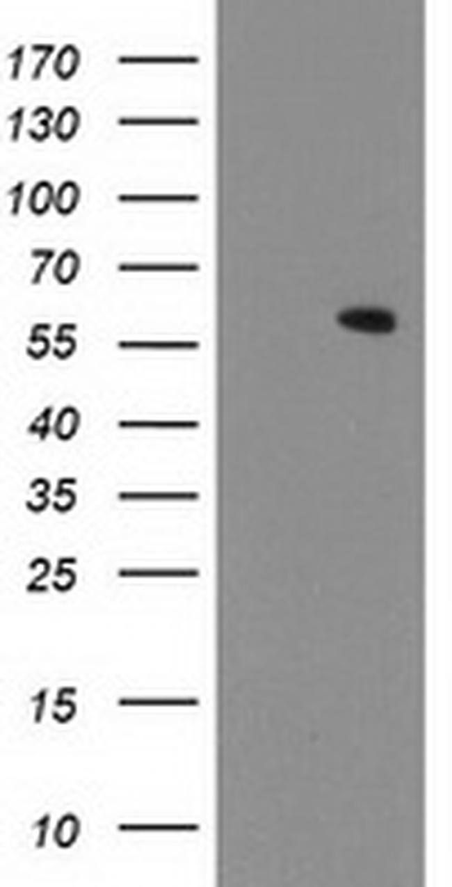 MKRN1 Antibody in Western Blot (WB)