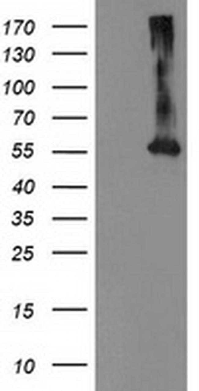 MKRN1 Antibody in Western Blot (WB)