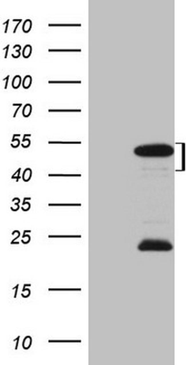 MKX Antibody in Western Blot (WB)
