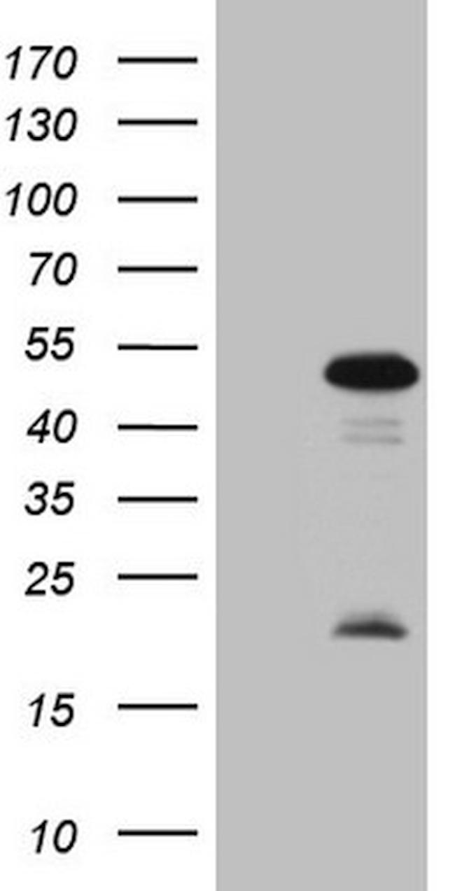 MKX Antibody in Western Blot (WB)