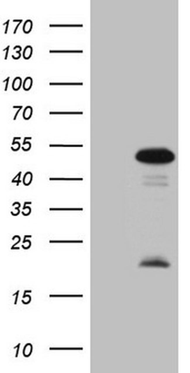 MKX Antibody in Western Blot (WB)
