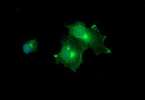 MLANA Antibody in Immunocytochemistry (ICC/IF)