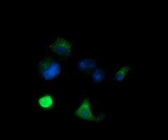 MLANA Antibody in Immunocytochemistry (ICC/IF)