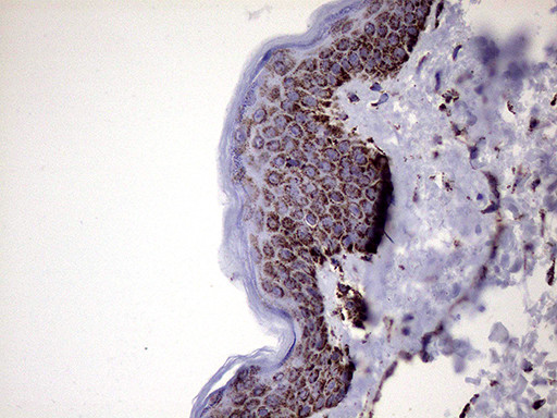 MLANA Antibody in Immunohistochemistry (Paraffin) (IHC (P))