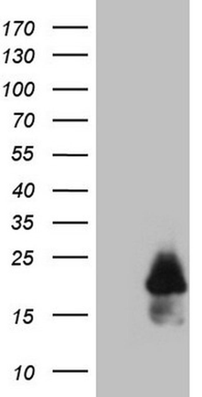 MLANA Antibody in Western Blot (WB)