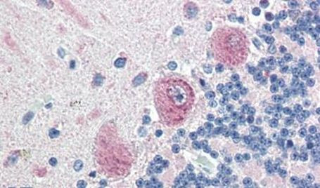 MLEC Antibody in Immunohistochemistry (Paraffin) (IHC (P))