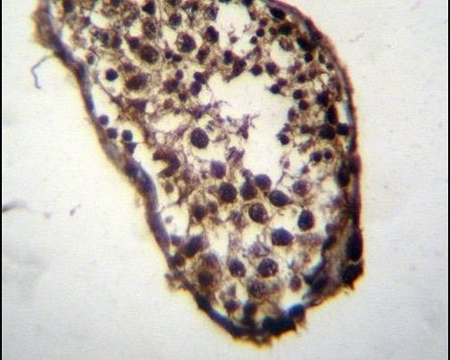 MLF1 Antibody in Immunohistochemistry (IHC)