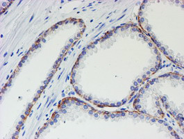 MLF1 Antibody in Immunohistochemistry (Paraffin) (IHC (P))
