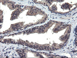 MLF1 Antibody in Immunohistochemistry (Paraffin) (IHC (P))