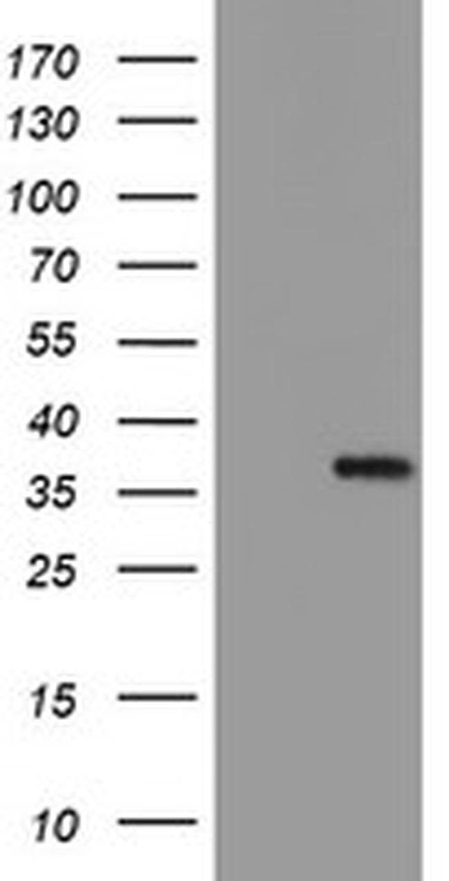 MLF1 Antibody in Western Blot (WB)