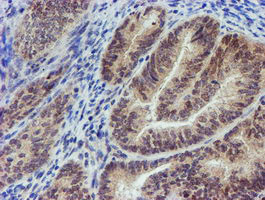 MLF2 Antibody in Immunohistochemistry (Paraffin) (IHC (P))