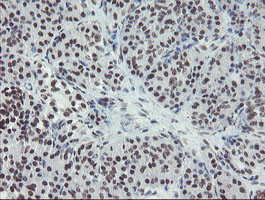 MLF2 Antibody in Immunohistochemistry (Paraffin) (IHC (P))