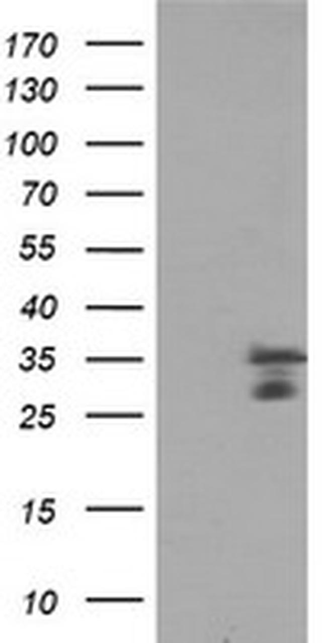 MLF2 Antibody in Western Blot (WB)