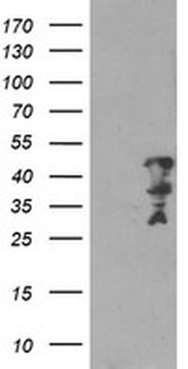 MLF2 Antibody in Western Blot (WB)