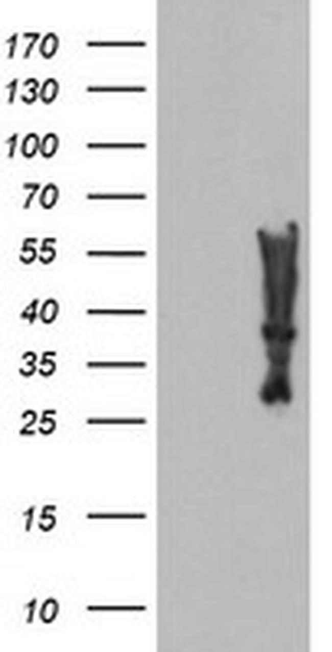 MLF2 Antibody in Western Blot (WB)