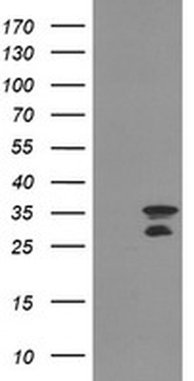 MLF2 Antibody in Western Blot (WB)