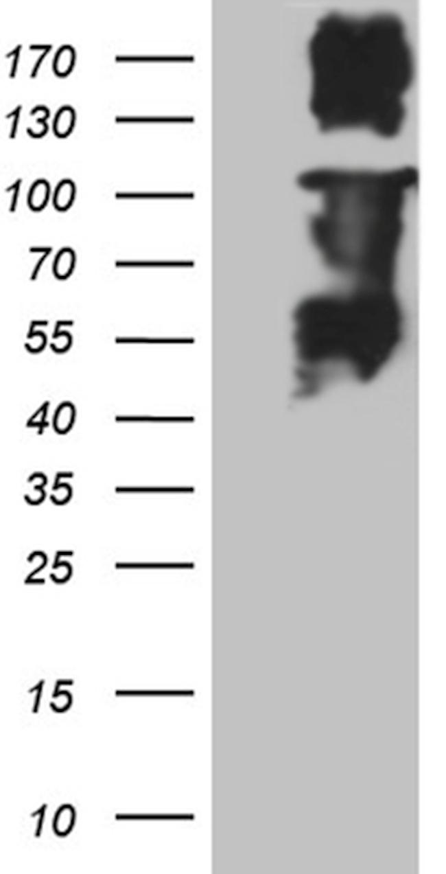 MLH1 Antibody in Western Blot (WB)
