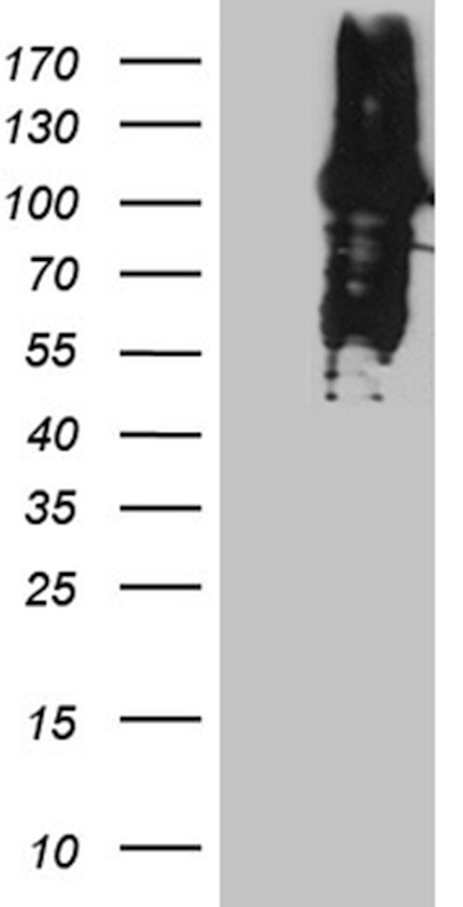 MLH1 Antibody in Western Blot (WB)