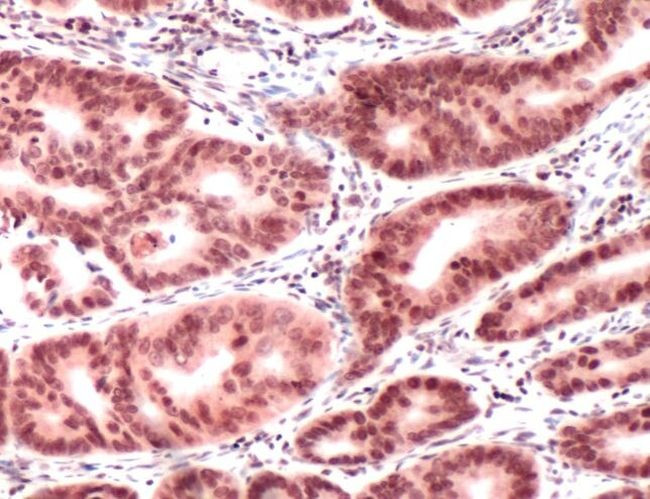 MLH1 Antibody in Immunohistochemistry (IHC)