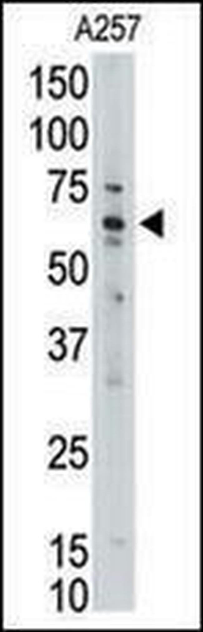 MLLT1 Antibody in Western Blot (WB)