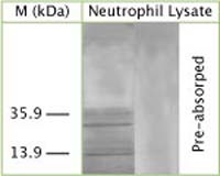 LC3A Antibody in Western Blot (WB)