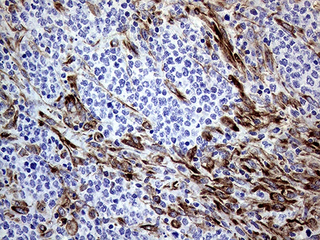 MLPH Antibody in Immunohistochemistry (Paraffin) (IHC (P))
