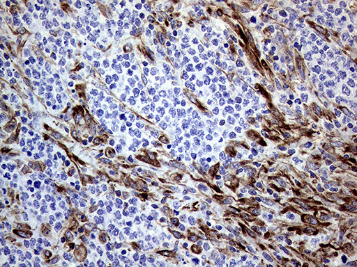 MLPH Antibody in Immunohistochemistry (Paraffin) (IHC (P))