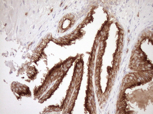 MLPH Antibody in Immunohistochemistry (Paraffin) (IHC (P))
