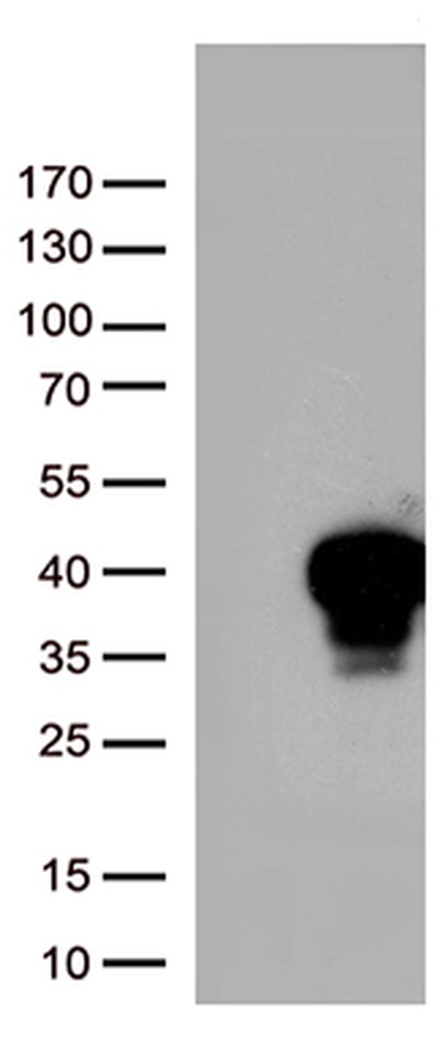 MLX Antibody in Western Blot (WB)