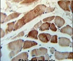 MMAA Antibody in Immunohistochemistry (IHC)