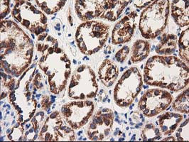 MMAA Antibody in Immunohistochemistry (Paraffin) (IHC (P))