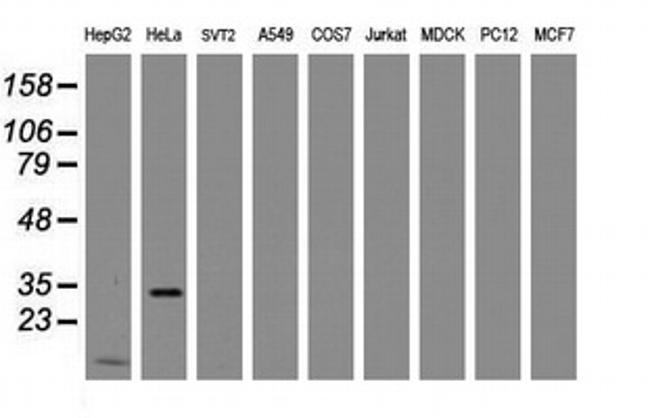 MMADHC Antibody in Western Blot (WB)