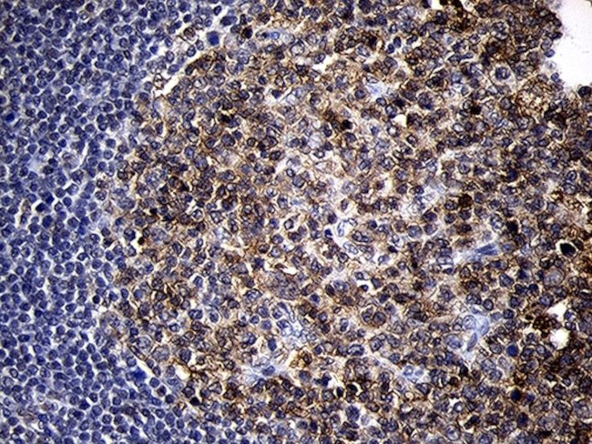 MME Antibody in Immunohistochemistry (Paraffin) (IHC (P))