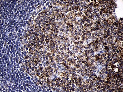 MME Antibody in Immunohistochemistry (Paraffin) (IHC (P))