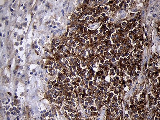 MME Antibody in Immunohistochemistry (Paraffin) (IHC (P))
