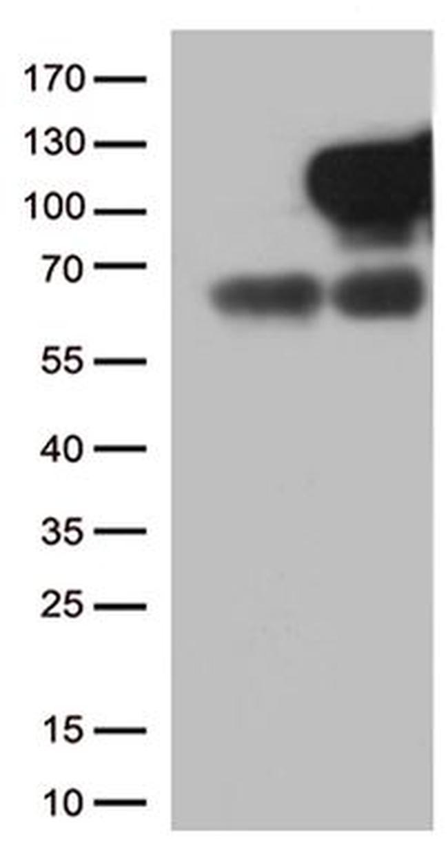 MME Antibody in Western Blot (WB)