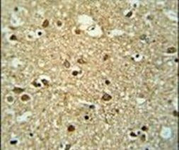 MMGT1 Antibody in Immunohistochemistry (IHC)