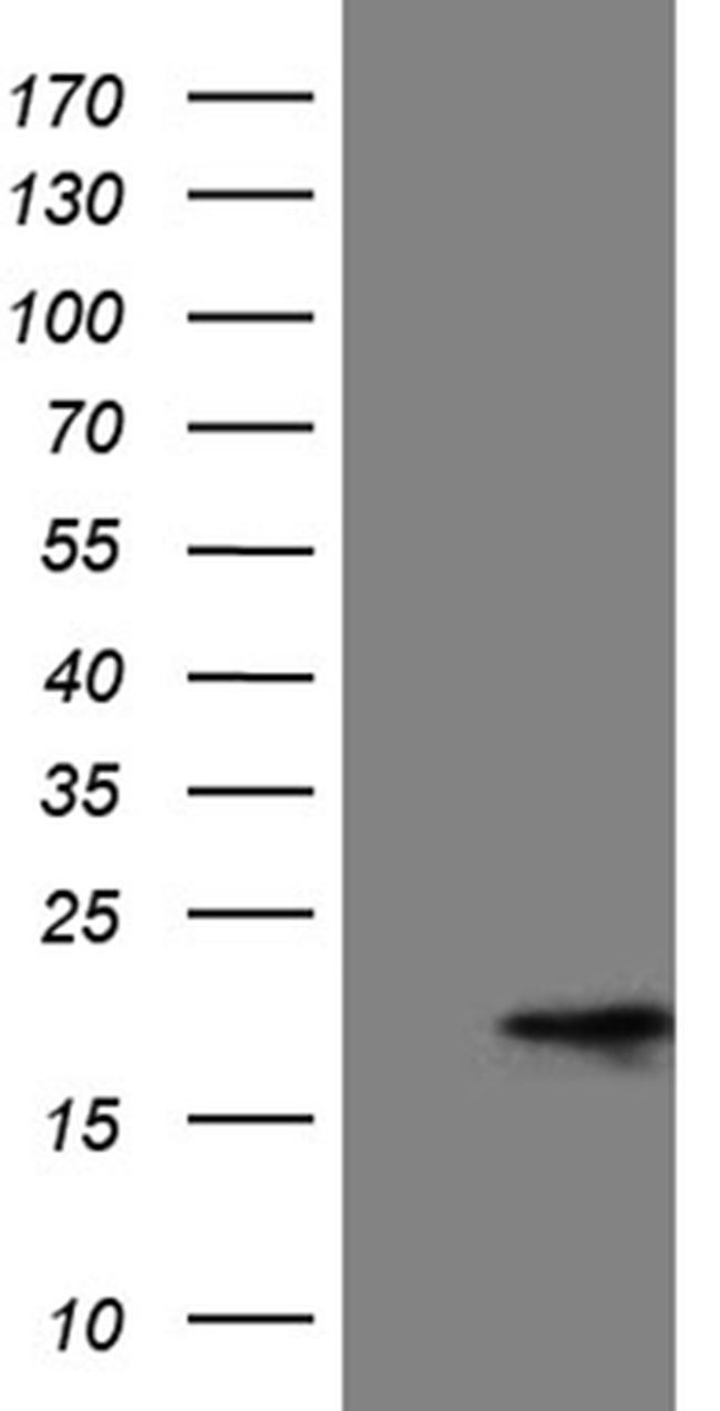 MMGT1 Antibody in Western Blot (WB)
