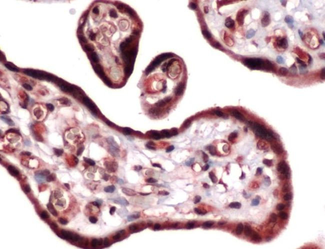 MMP14 Antibody in Immunohistochemistry (IHC)