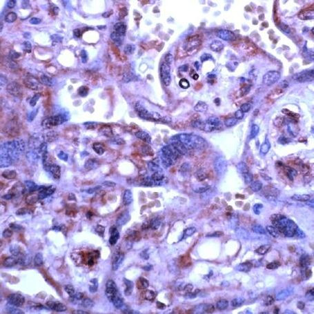 MMP15 Antibody in Immunohistochemistry (Paraffin) (IHC (P))