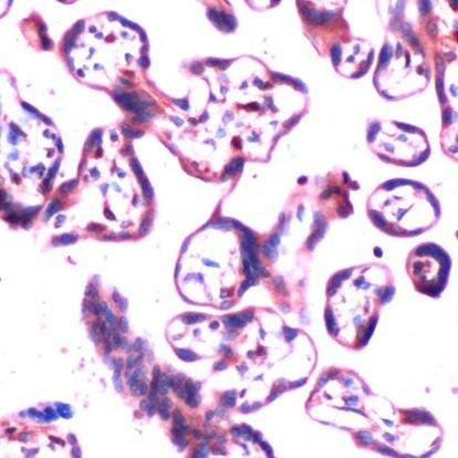 MMP2 Antibody in Immunohistochemistry (IHC)