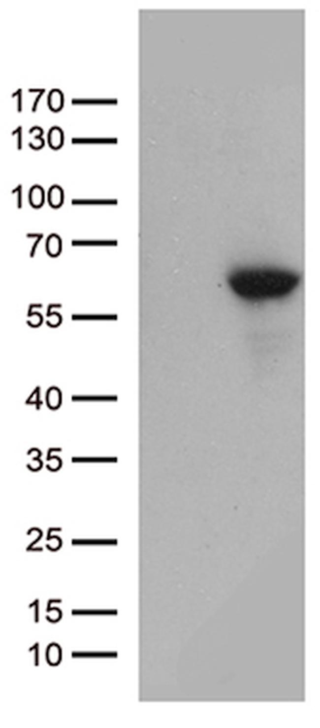 MMP11 Antibody in Western Blot (WB)