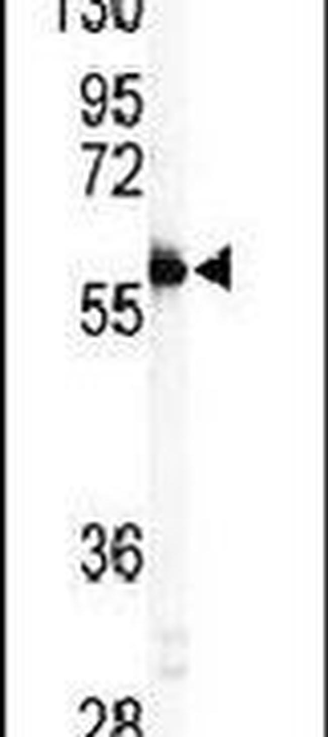 MMP11 Antibody in Western Blot (WB)
