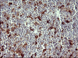 MMP13 Antibody in Immunohistochemistry (Paraffin) (IHC (P))