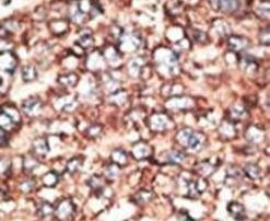 MMP17 Antibody in Immunohistochemistry (IHC)