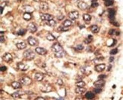 MMP24 Antibody in Immunohistochemistry (IHC)